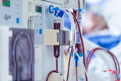 Dialysis Equipment